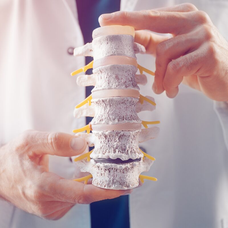 back pain chiropractor in San Diego, California